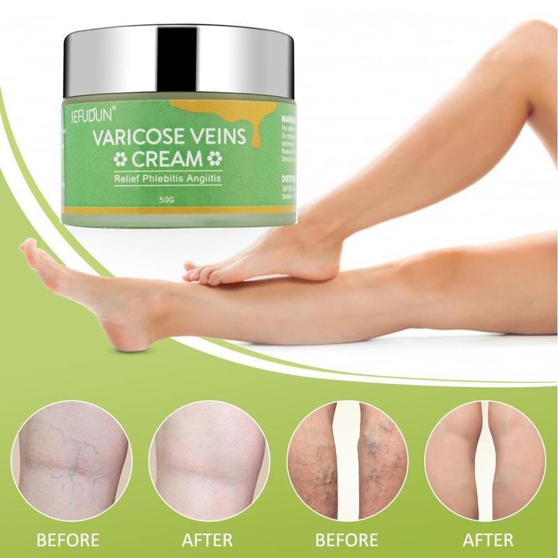 Vein Cream - Varicose & Bruise Relief